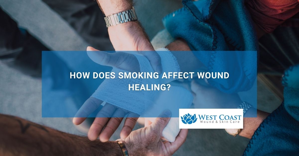 How Does Smoking Affect Wound Healing