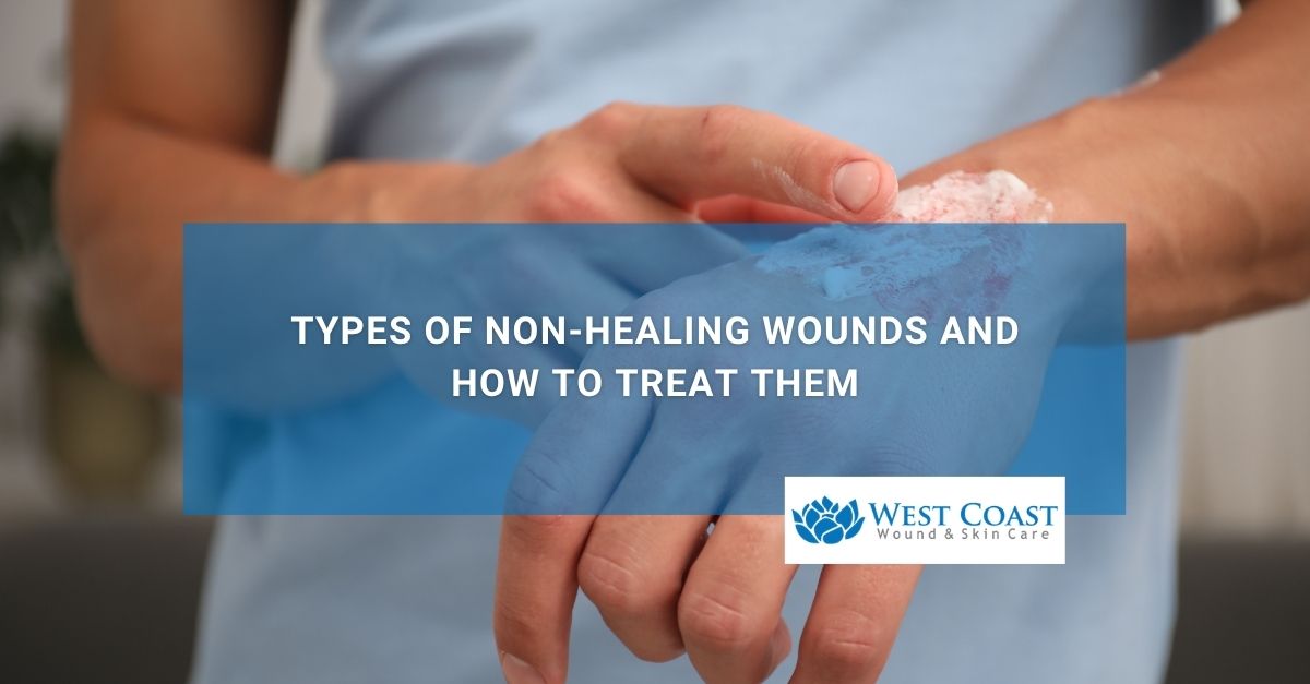 Types of Non Healing Wounds and How to Treat Them