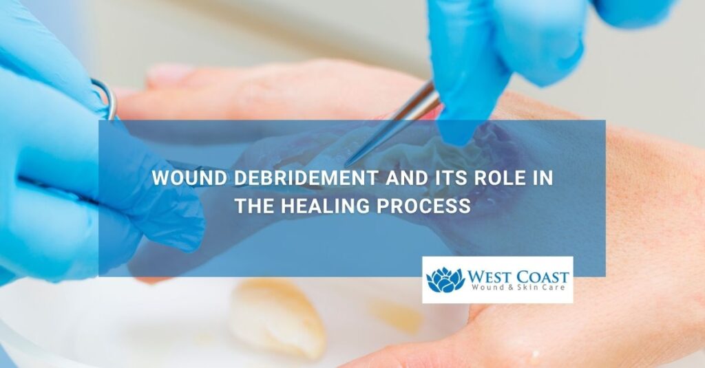 Wound Debridement and Its Role in the Healing Process