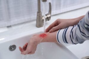 woman washing a wound to prevent infection