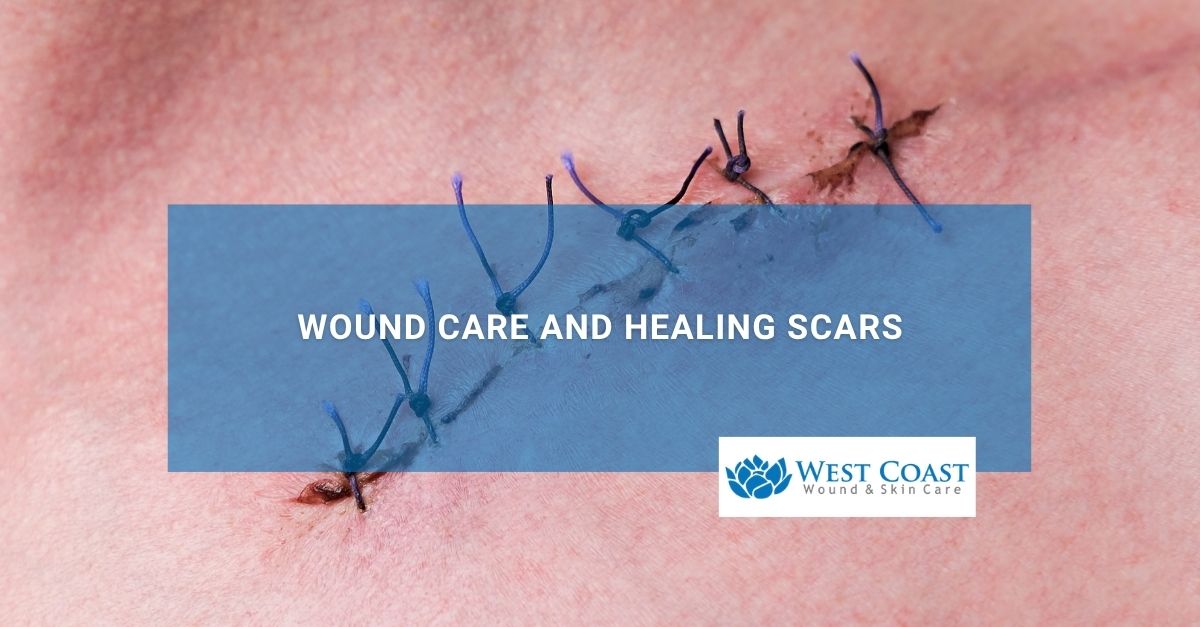Wound Care and Healing Scars