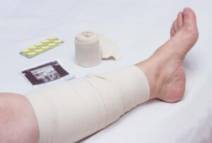 How Compression Therapy Enhances Wound Healing