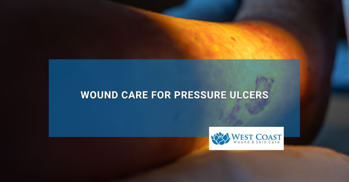 Wound Care for Pressure Ulcers
