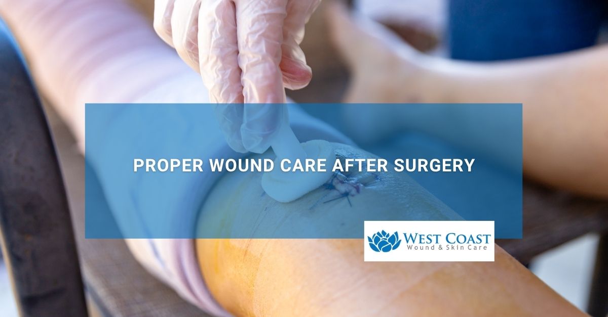Proper Wound Care After Surgery