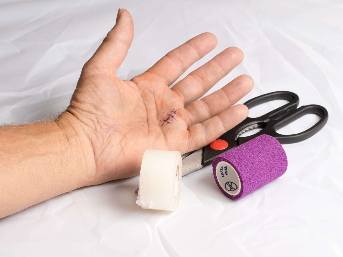 Wound Care After Surgery Healing Post Surgical Wounds