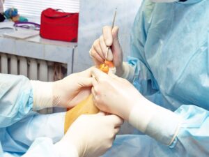 wound care specialist treating osteomyelitis with surgery