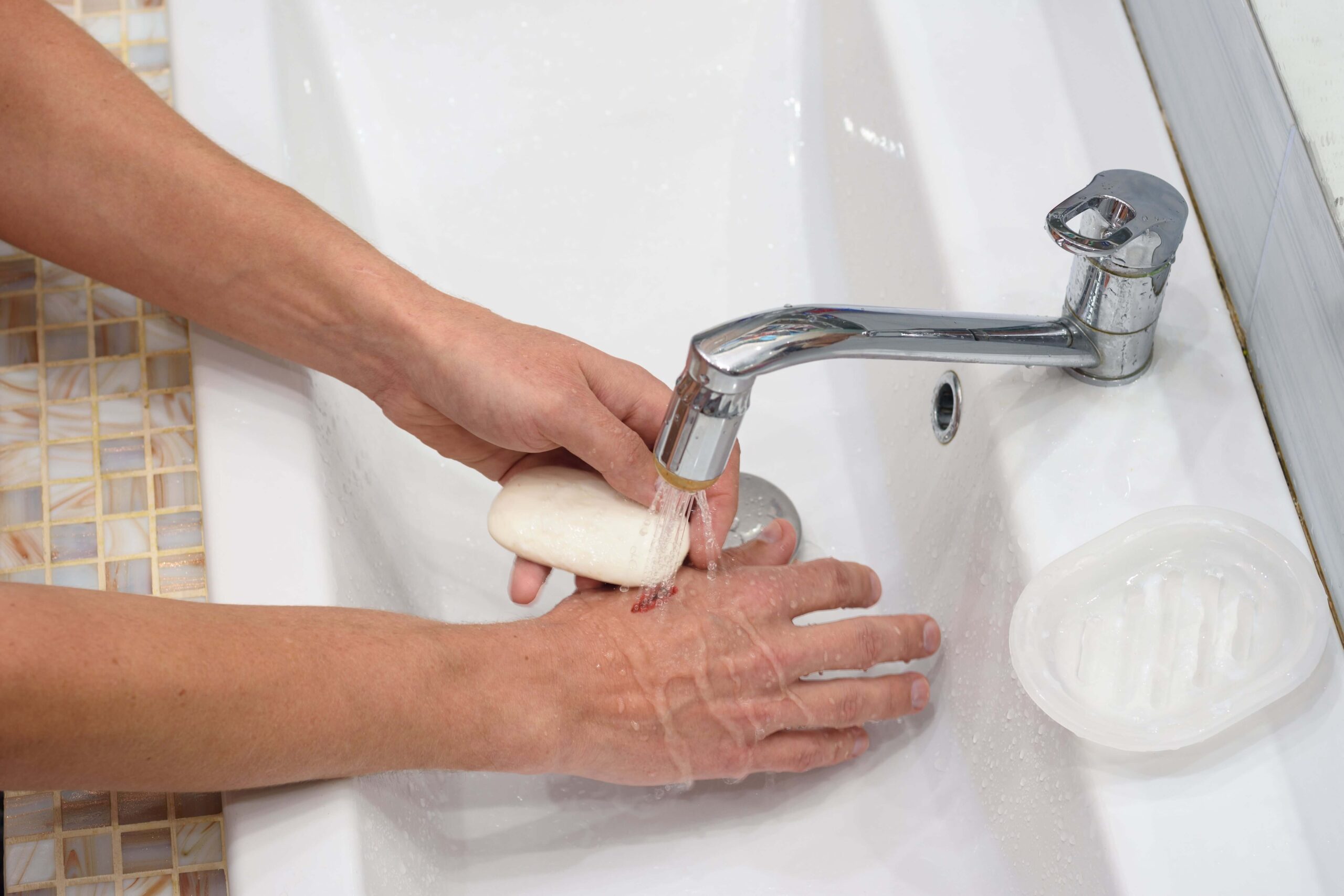 man washing an animal bite wound