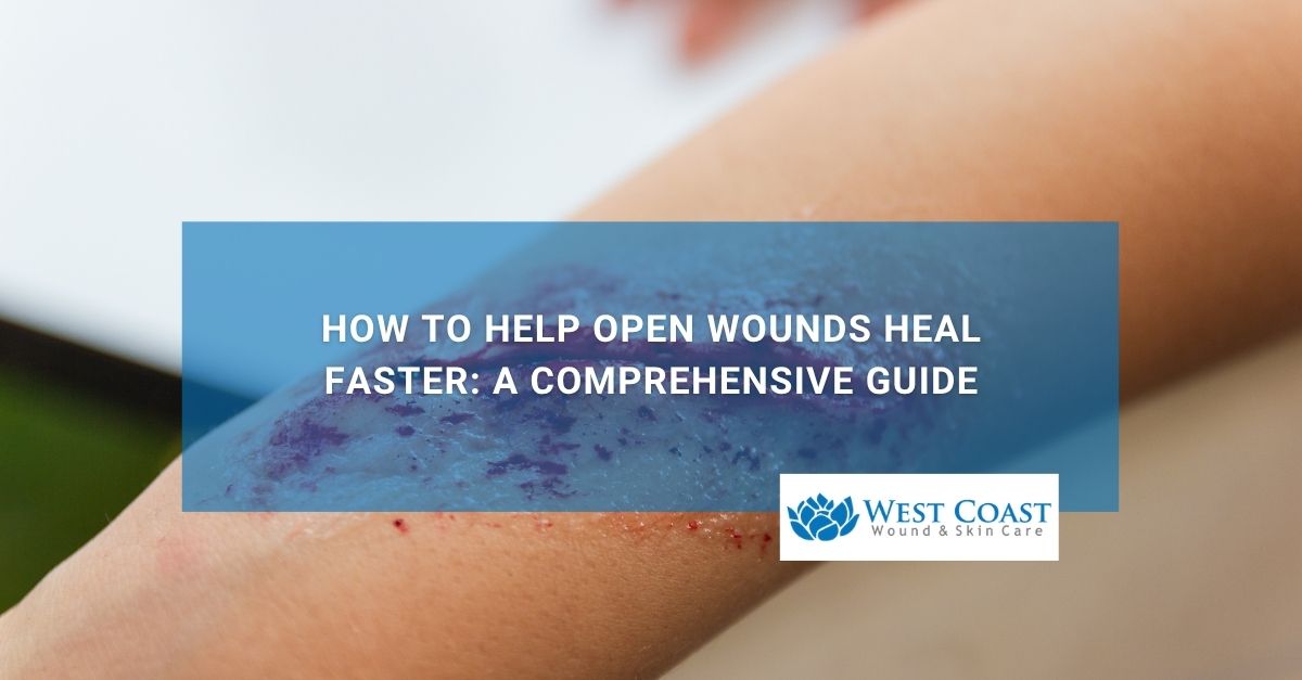How to Help Open Wounds Heal Faster A Comprehensive Guide