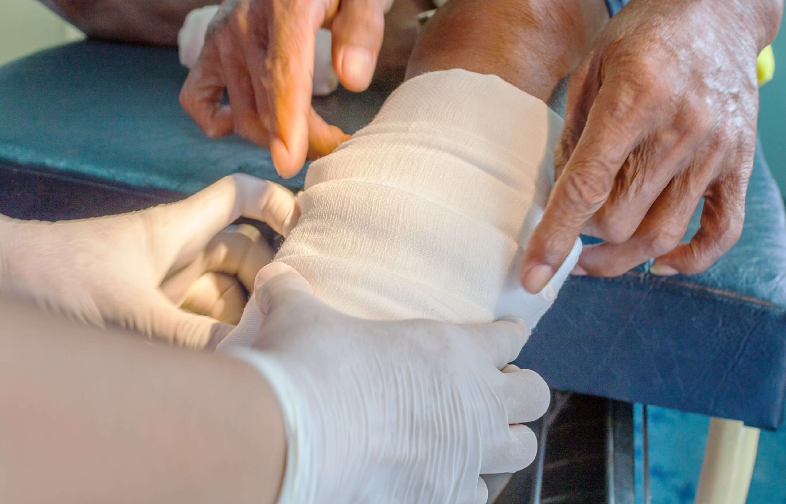 specialist treating a necrotic wound