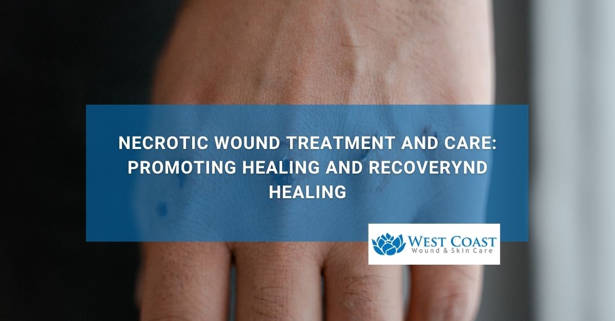 Necrotic Wound Treatment and Care Promoting Healing and Recovery