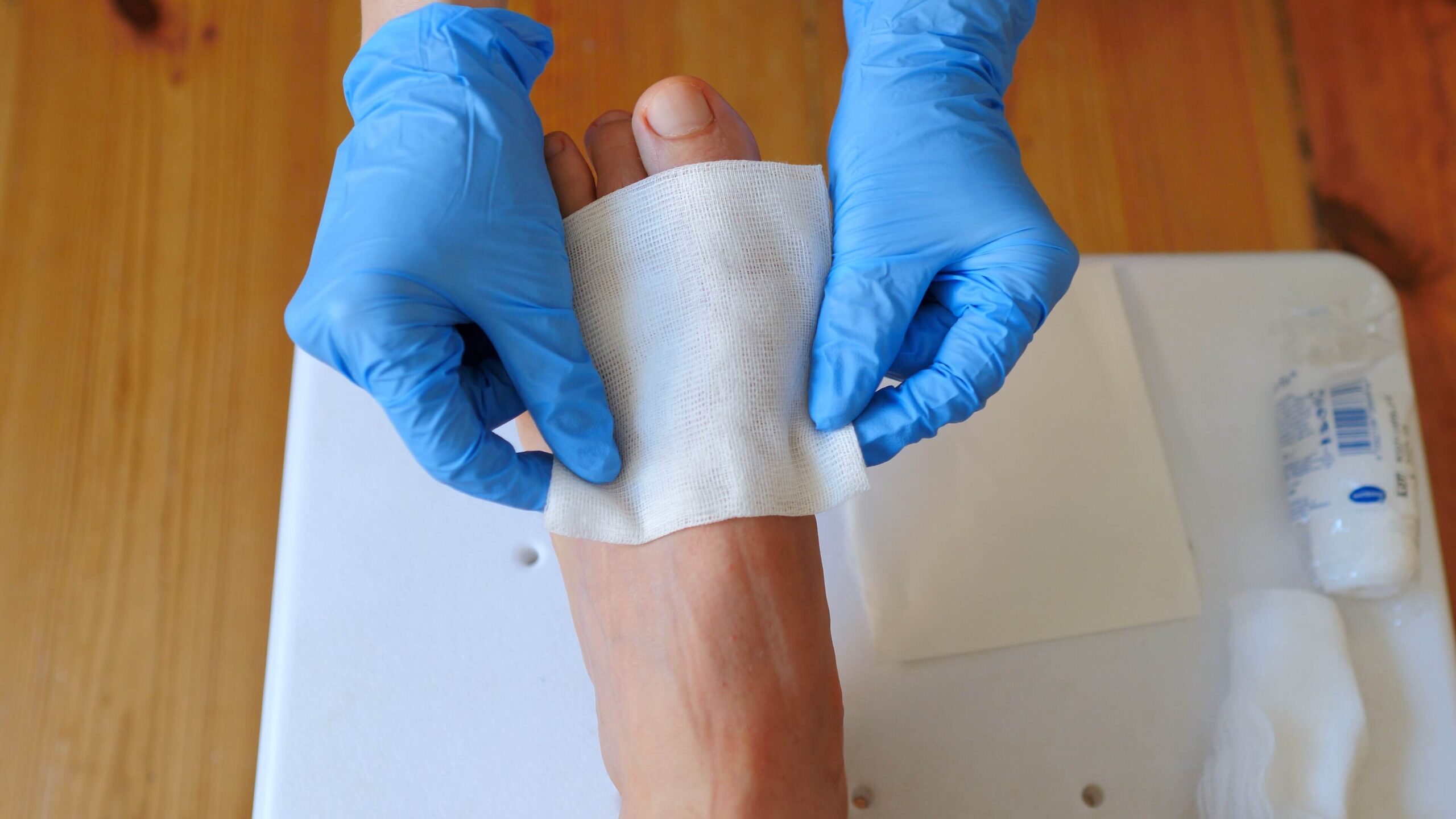 specialist treating a tunneling foot wound, wound treatment