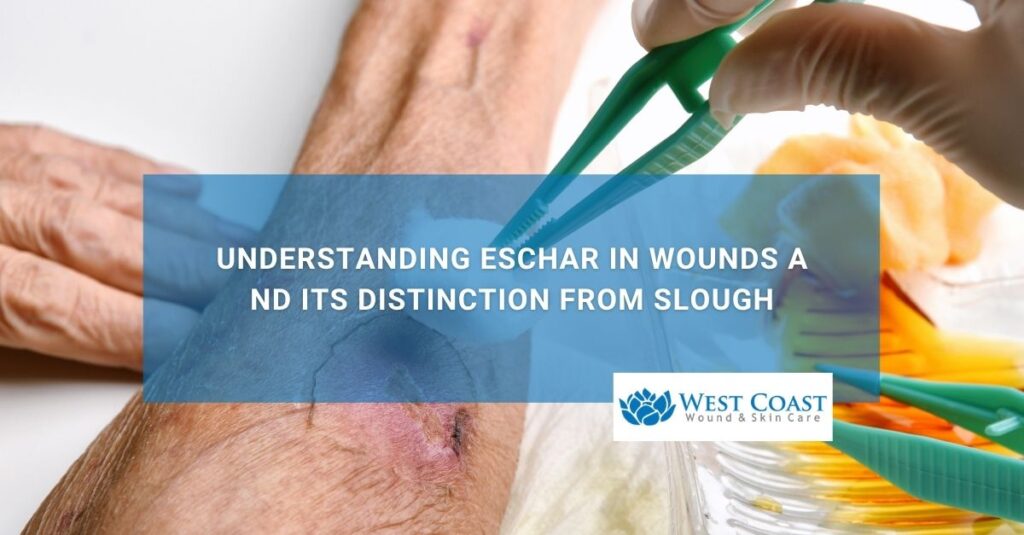 Understanding Eschar in Wounds and Its Distinction from Slough