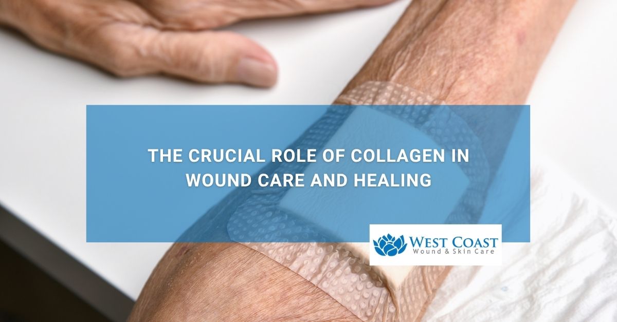The Crucial Role of Collagen in Wound Care and Healing