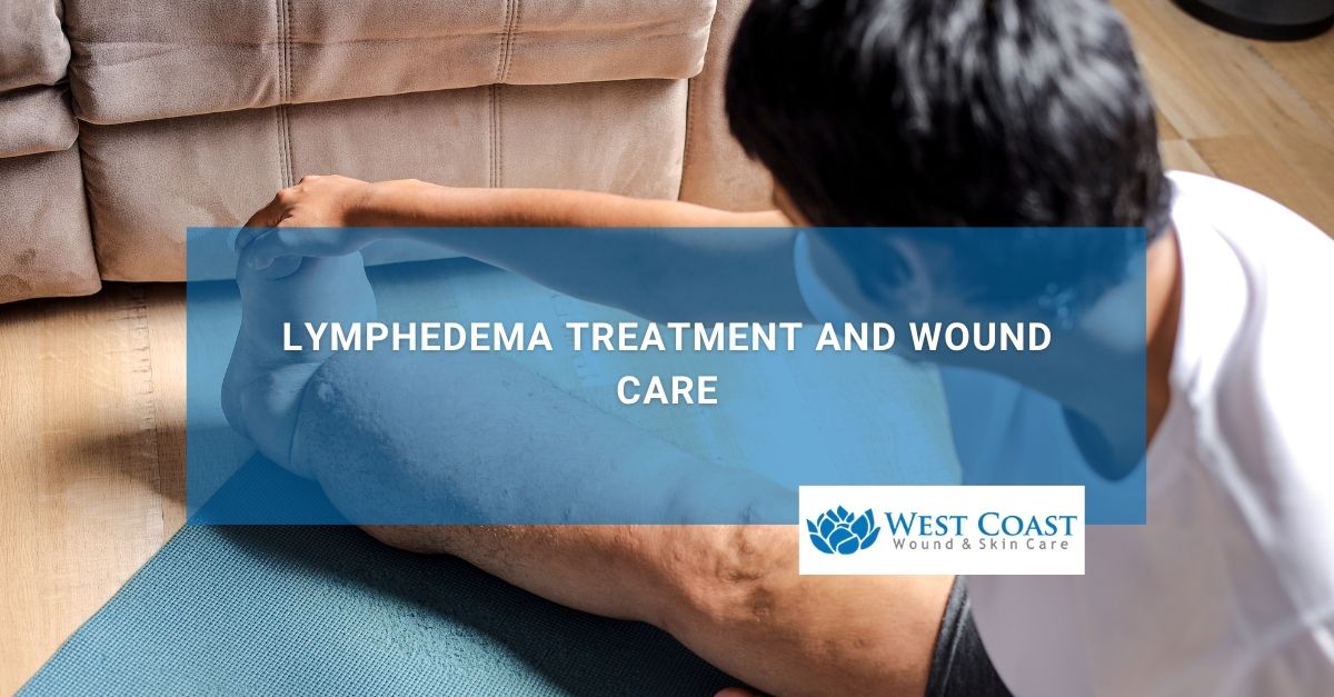 Lymphedema Treatment and Wound Care