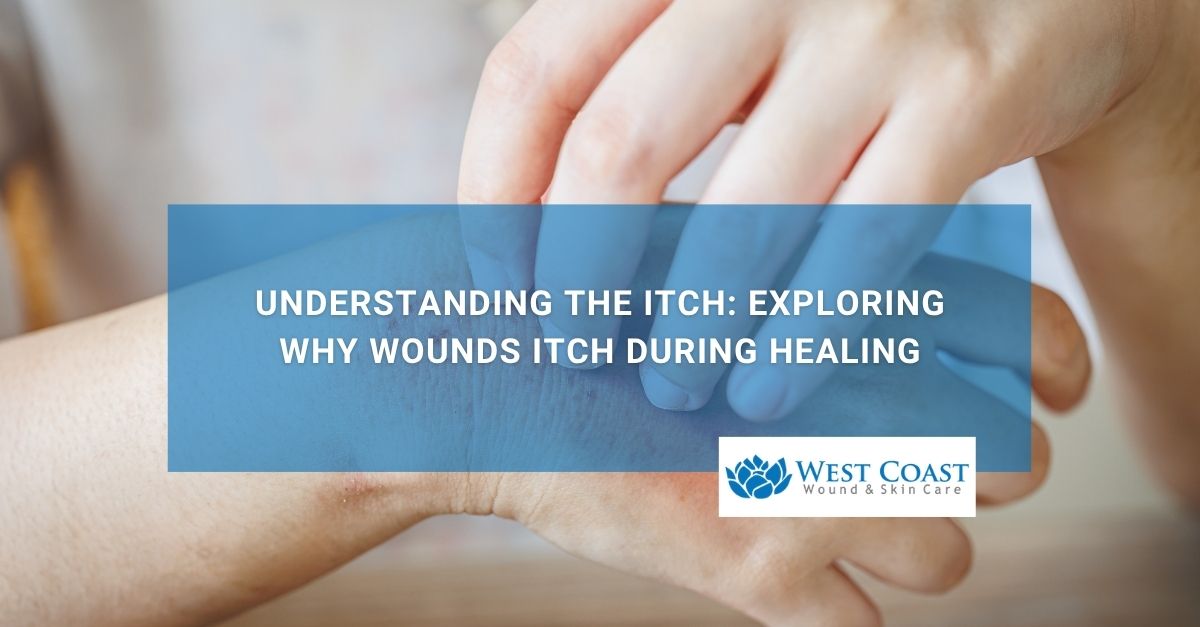 Understanding the Itch Exploring Why Wounds Itch During Healing