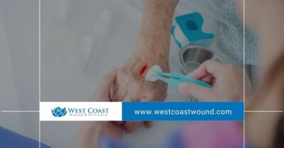 Treatment for Wounds: A Guide to Effective Healing