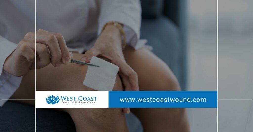 wound care centers