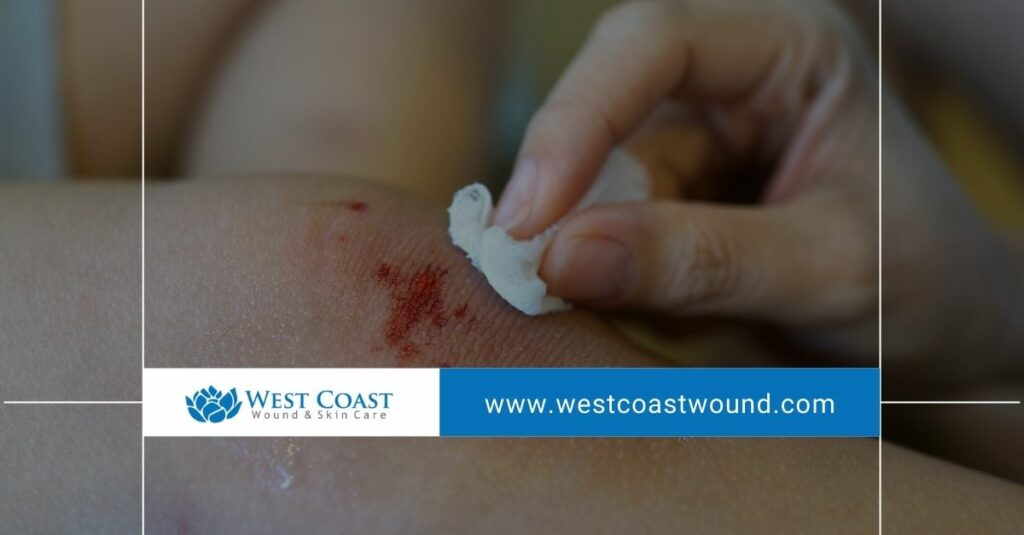 advanced wound care
