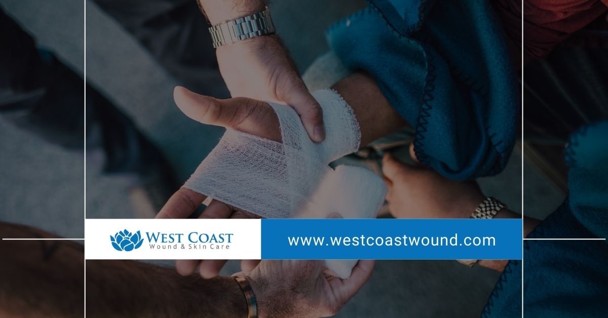 wound care