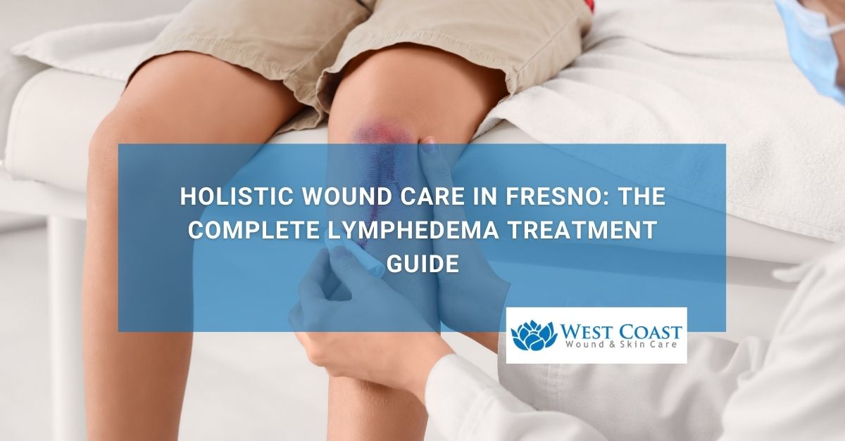 Preventing Pressure Injuries With Wound Care in Jacksonville