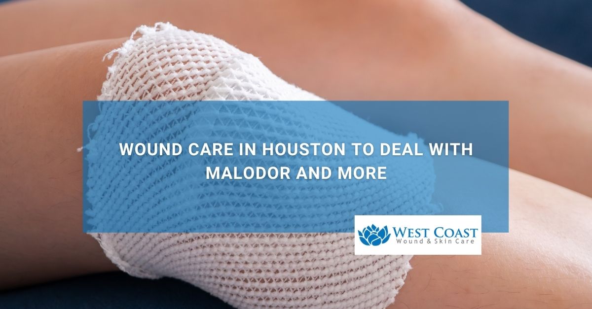 Wound Care in Houston to Deal with Malodor and More