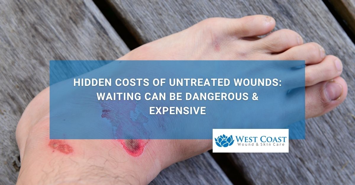Hidden Costs of Untreated Wounds Waiting Can Be Dangerous & Expensive
