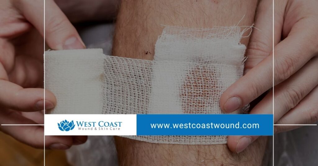 complications of untreated chronic wounds