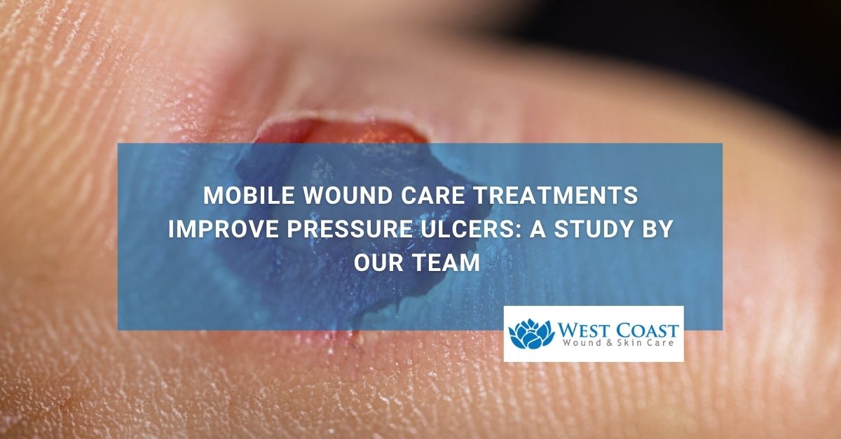 Mobile Wound Care Treatments Improve Pressure Ulcers A Study By Our Team  ()