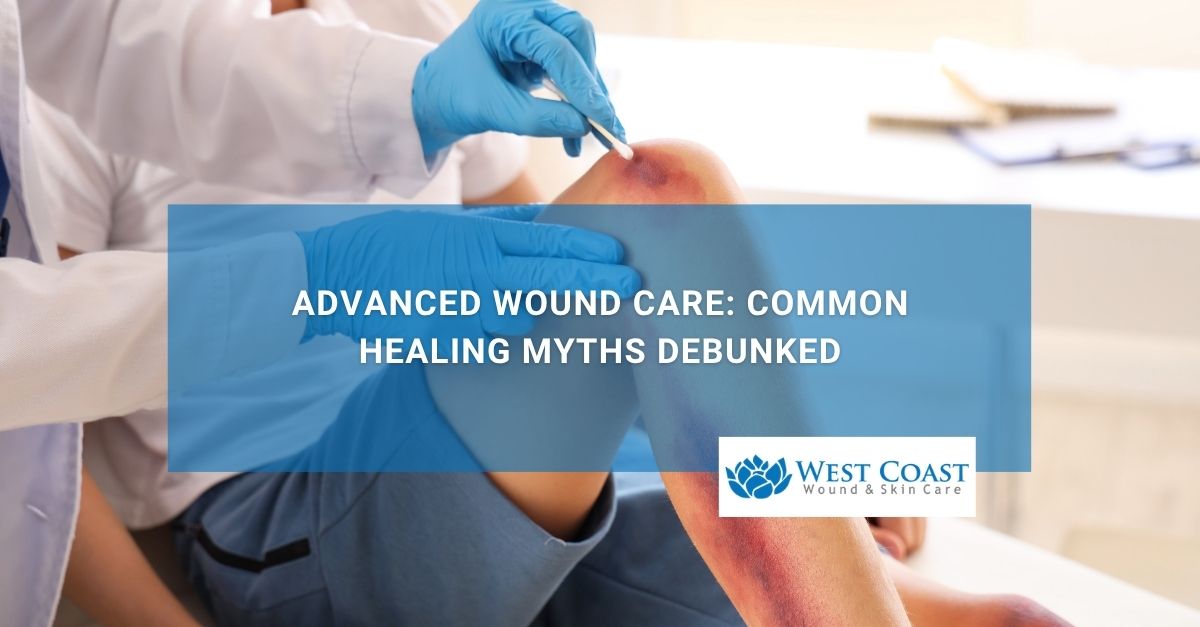 Advanced Wound Care Common Healing Myths Debunked