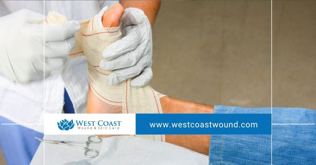 Wound Healing