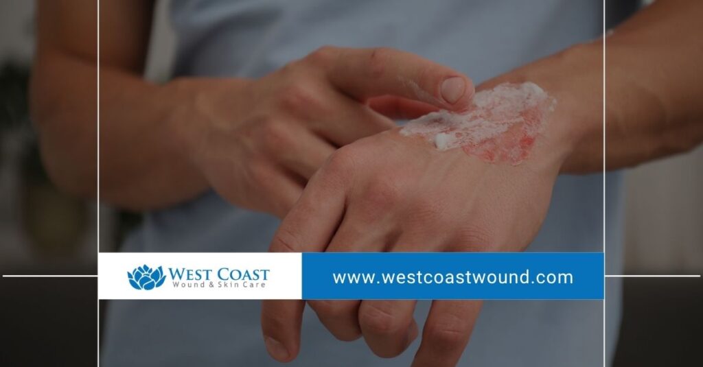Wound Healing Myths