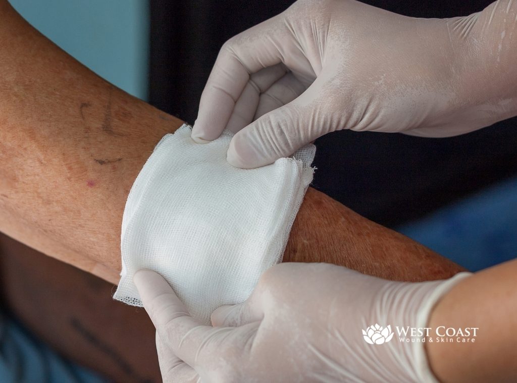 DETROIT MOBILE WOUND CARE
