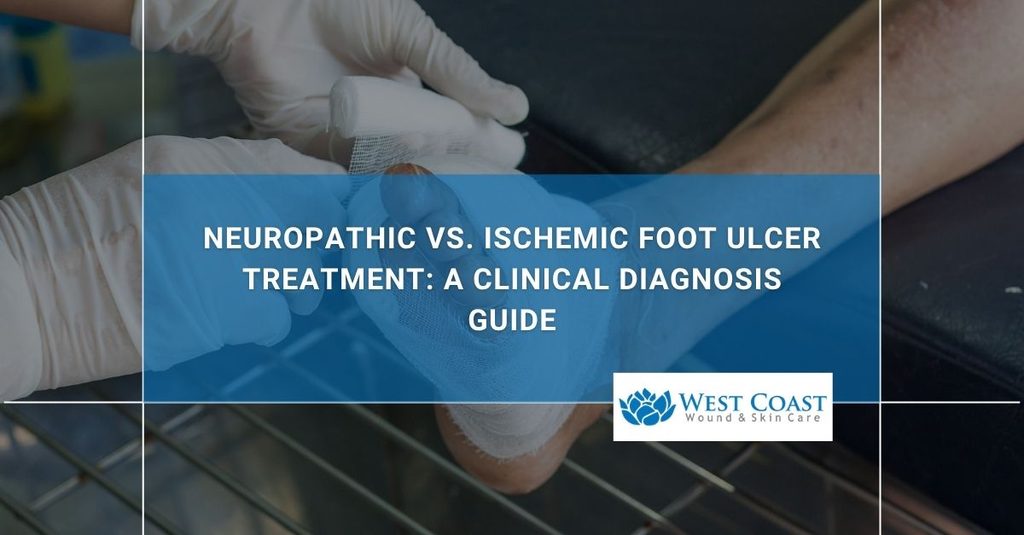 Neuropathic vs Ischemic Foot Ulcer Treatment A Clinical Diagnosis Guide