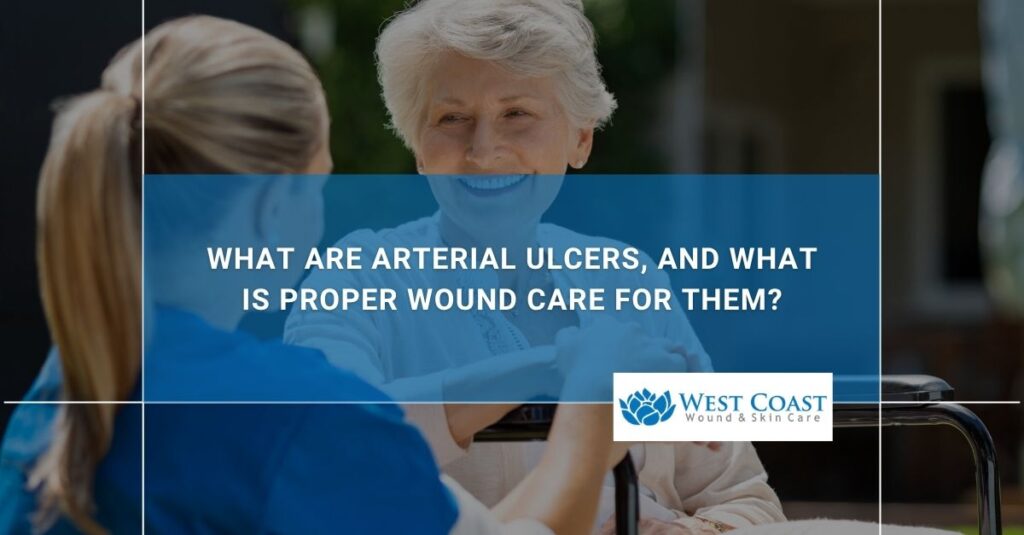What Are Arterial Ulcers, and What is Proper Wound Care For Them